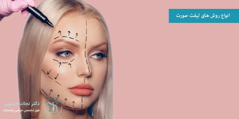 انواع روش های لیفت صورت