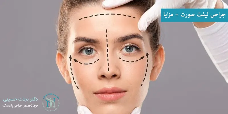 جراحی لیفت صورت + مزایا