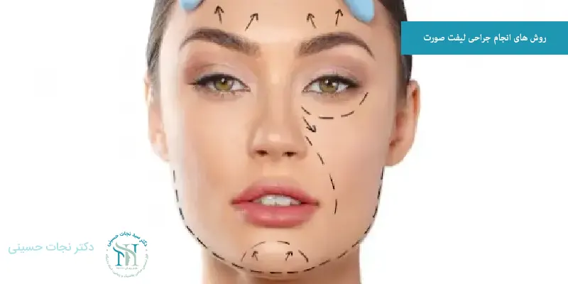 روش های انجام جراحی لیفت صورت