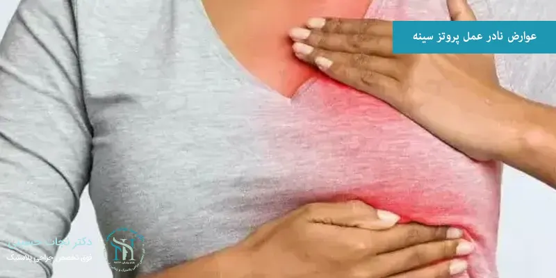 عوارض نادر عمل پروتز سینه