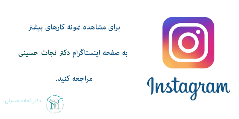 مشاهده-نمونه-کار-اینستا