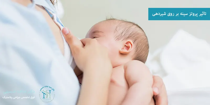 تاثیر پروتز سینه بر روی شیردهی