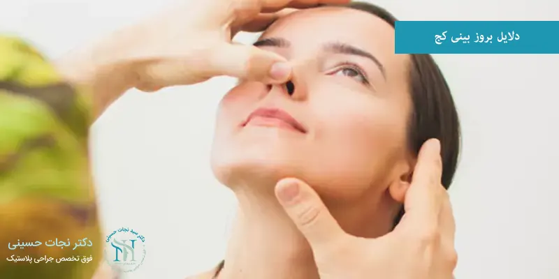 دلایل بروز بینی کج