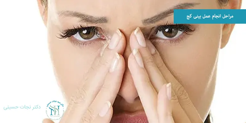 مراحل انجام عمل بینی کج
